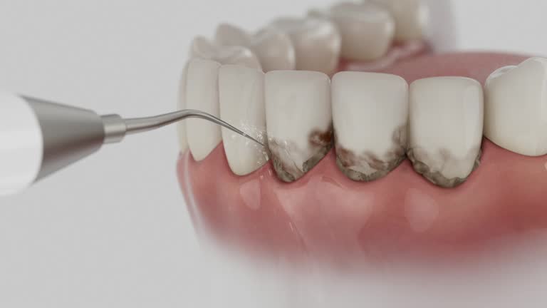 Reliable Dental contractor in San Ramon, CA by Dentist Open Now